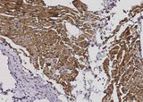 Anti-Mouse S100A1 Antibody [A1228] - ABMIUM