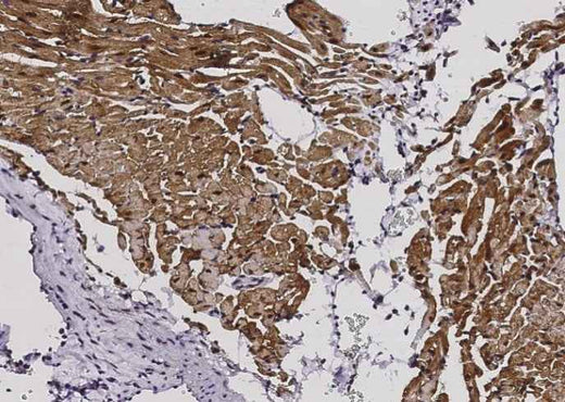 Anti-Mouse S100A1 Antibody [A1228] - ABMIUM