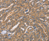 Anti-Human/Mouse CDCA4 Antibody - ABMIUM