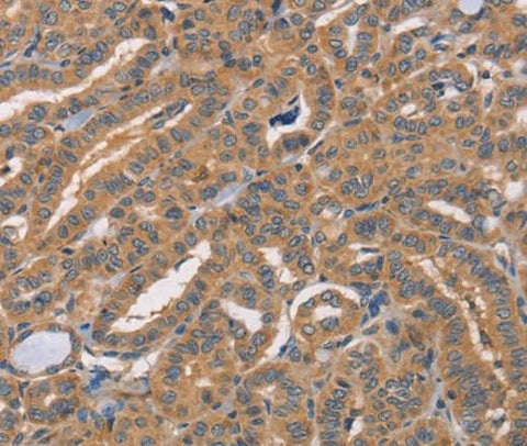 Anti-Human/Mouse CDCA4 Antibody - ABMIUM