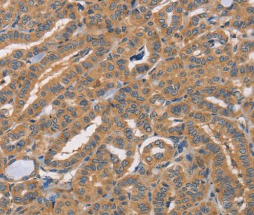 Anti-Human/Mouse CDCA4 Antibody - ABMIUM