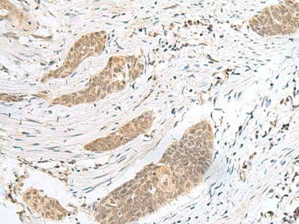 Anti-Human/Mouse/Rat ENSA Antibody