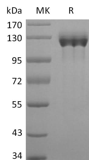Recombinant Human G-CSFR/CD114/CSF3R (C-Fc) - ABMIUM