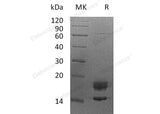 Recombinant Human Myelin Protein P0/MPZ Protein (His Tag) - ABMIUM