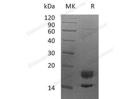 Recombinant Human Myelin Protein P0/MPZ Protein (His Tag) - ABMIUM