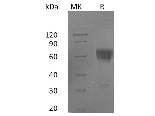 Recombinant Human FAS/TNFRSF6 Protein (Fc Tag) - ABMIUM