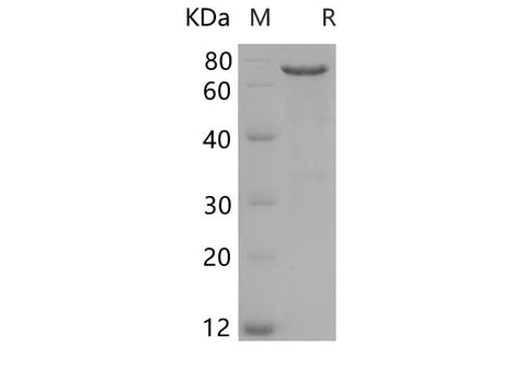 SDS-PAGE analysis of Human Merlin/NF2 proteins, 2 μg/lane of Recombinant Human Merlin/NF2 proteins was resolved with SDS-PAGE under reducing conditions, showing bands at 68-71 kDa.