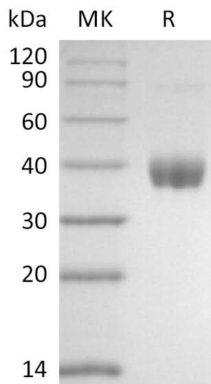 Recombinant SARS-CoV-2 Spike RBD-SD1(V367F)(His Tag) - ABMIUM