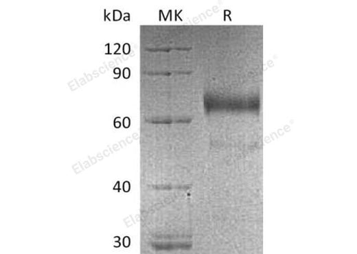 Recombinant Human KIR2DL3/NKAT2 Protein (Fc Tag) - ABMIUM