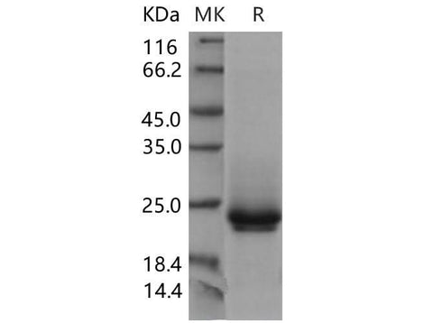 Recombinant Mouse Frizzled-10/FZD10 Protein (His Tag) - ABMIUM