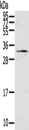 Anti-Human/Mouse/Rat STAR Antibody - ABMIUM
