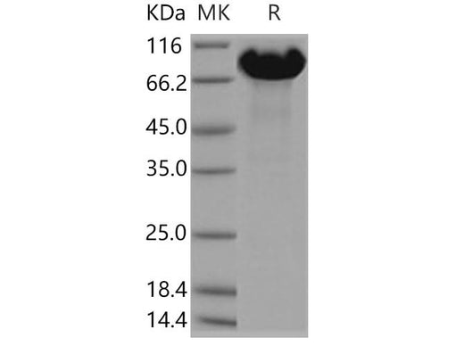 Recombinant Human APLP-1 Protein (aa 1-580, His Tag) - ABMIUM