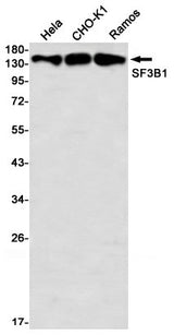 Western blot detection of SF3B1 in Hela,CHO-K1,C6,Ramos using SF3B1 Rabbit mAb(1:1000 diluted)