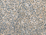 Immunohistochemistry of paraffin-embedded Human tonsil tissue using RAB3IP Polyclonal Antibody at dilution of 1:60(×200)