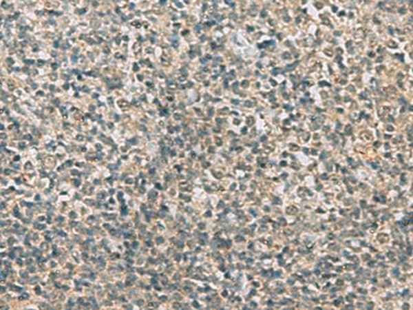 Anti-Human/Mouse/Rat RAB3IP Antibody