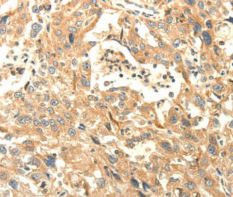 Anti-Human AGRN Antibody - ABMIUM