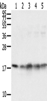 Anti-Human/Mouse/Rat TAF11 Antibody - ABMIUM