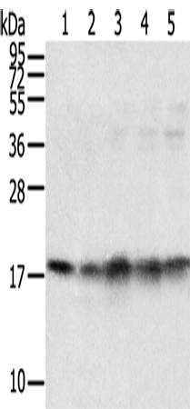 Anti-Human/Mouse/Rat TAF11 Antibody - ABMIUM
