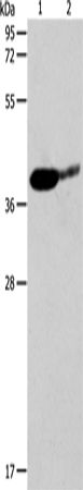 Anti-Human/Mouse SIRT3 Antibody - ABMIUM