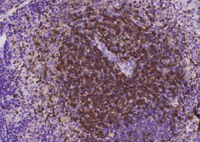 Anti-Mouse CD27 Antibody [B407] - ABMIUM