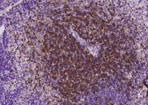 Anti-Mouse CD27 Antibody [B407] - ABMIUM