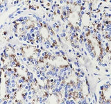 Anti-Human SLC45A3 Antibody [A654]