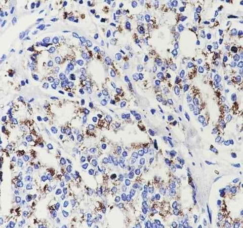 Anti-Human SLC45A3 Antibody [A654] - ABMIUM