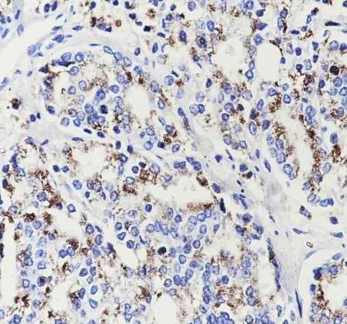 Anti-Human SLC45A3 Antibody [A654]