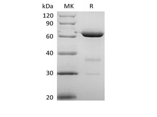 Recombinant Human 5'-Nucleotidase/5'-NT/CD73 (P21589, C-6His) - ABMIUM