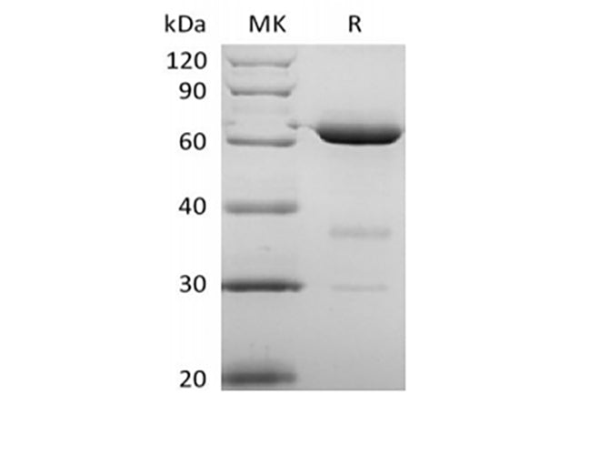 Recombinant Human 5'-Nucleotidase/5'-NT/CD73 (P21589, C-6His) - ABMIUM