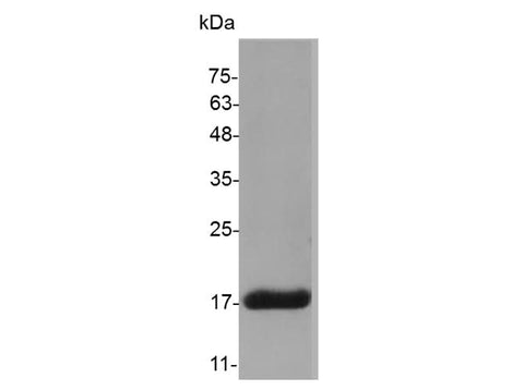 Recombinant Mouse IL-36 gamma protein(His Tag) - ABMIUM
