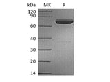 Recombinant Human IL-23 alpha & Mouse IL-12 beta Heterodimer (C-6His) - ABMIUM