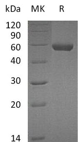Recombinant Mouse Carboxypeptidase M/CPM Protein (His Tag) - ABMIUM