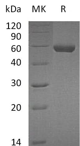Recombinant Mouse Carboxypeptidase M/CPM Protein (His Tag) - ABMIUM