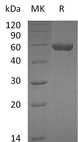 Recombinant Mouse Carboxypeptidase M/CPM Protein (His Tag) - ABMIUM