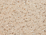 Immunohistochemistry of paraffin-embedded Human brain tissue using MCPH1 Polyclonal Antibody at dilution of 1:40(×200)