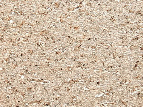 Immunohistochemistry of paraffin-embedded Human brain tissue using MCPH1 Polyclonal Antibody at dilution of 1:40(×200)