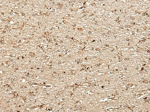 Immunohistochemistry of paraffin-embedded Human brain tissue using MCPH1 Polyclonal Antibody at dilution of 1:40(×200)