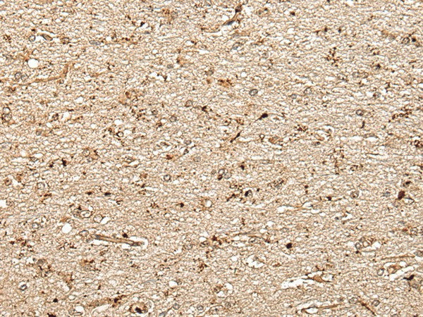 Immunohistochemistry of paraffin-embedded Human brain tissue using MCPH1 Polyclonal Antibody at dilution of 1:40(×200)
