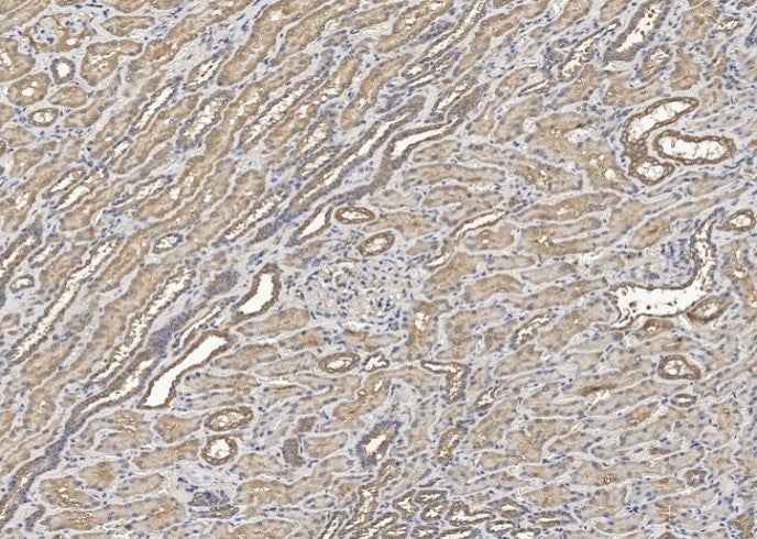 Anti-Human HGF Antibody [B105] - ABMIUM