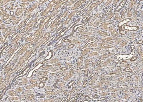 Anti-Human HGF Antibody [B105] - ABMIUM