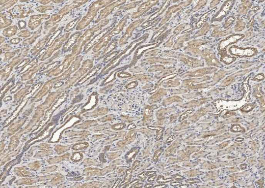 Anti-Human HGF Antibody [B105] - ABMIUM