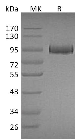Recombinant Mouse Myeloperoxidase/MPO Protein (His Tag) - ABMIUM