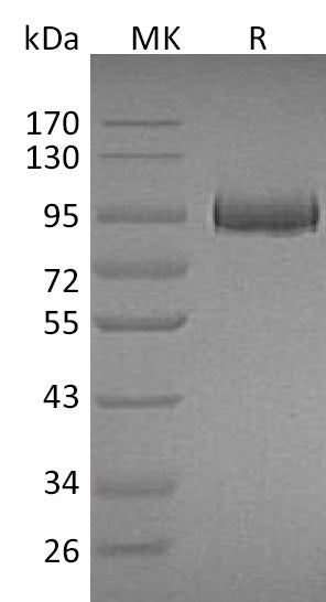 Recombinant Mouse Myeloperoxidase/MPO Protein (His Tag) - ABMIUM