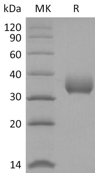 Recombinant SARS-CoV-2 Spike RBD (G476S)(His Tag) - ABMIUM
