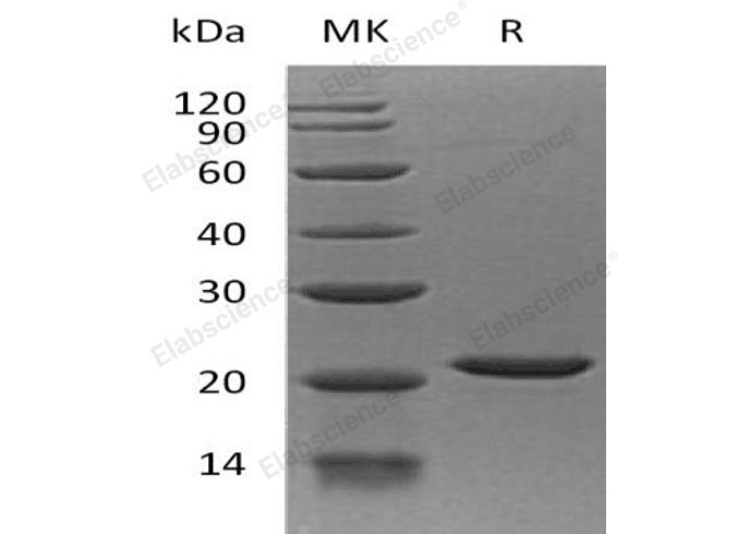 Recombinant Human EIF1AX Protein (His Tag) - ABMIUM