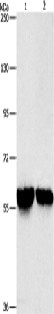 Anti-Human/Mouse ALDH8A1 Antibody - ABMIUM