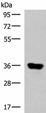 Western blot analysis of Human muscle tissue lysate using KCNK15 Polyclonal Antibody at dilution of 1:1000