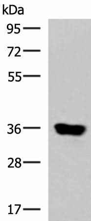 Anti-Human KCNK15 Antibody