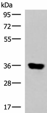 Western blot analysis of Human muscle tissue lysate using KCNK15 Polyclonal Antibody at dilution of 1:1000